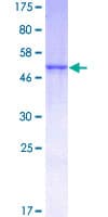 Human KLK1 / Kallikrein 1 Protein (Recombinant GST)