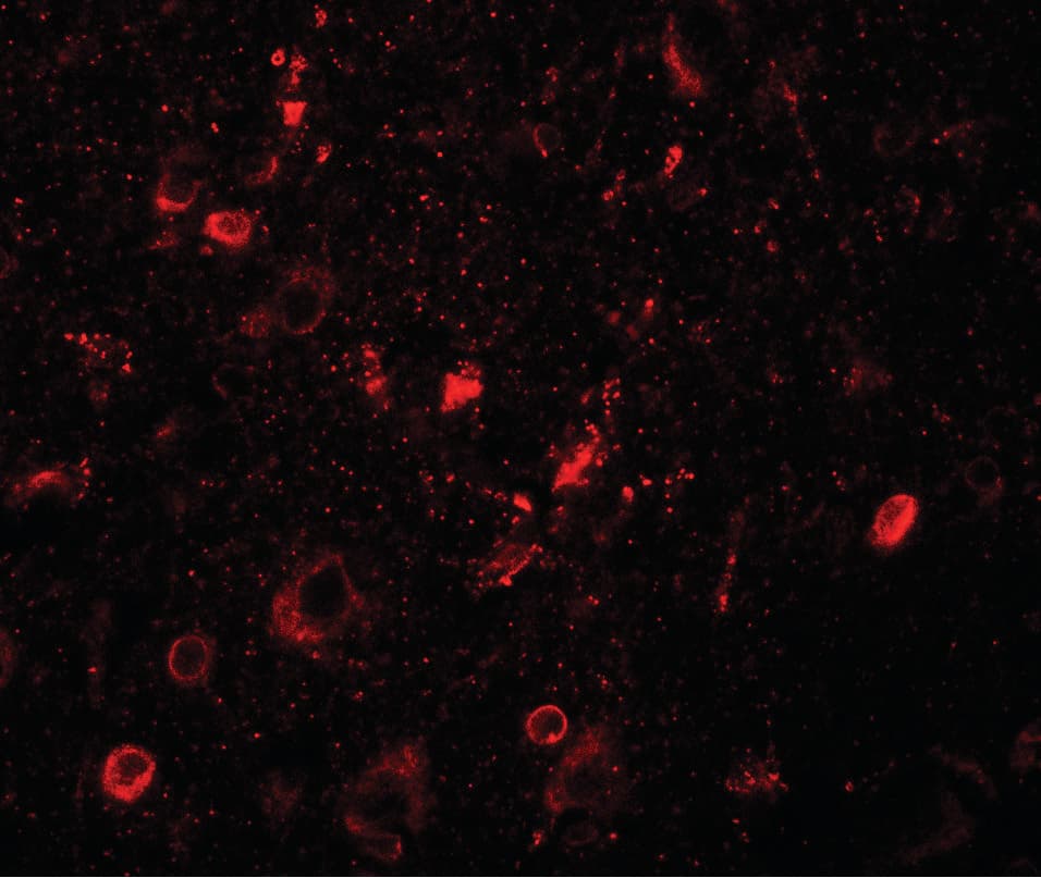 IHC-plus™ SGSM1 Antibody