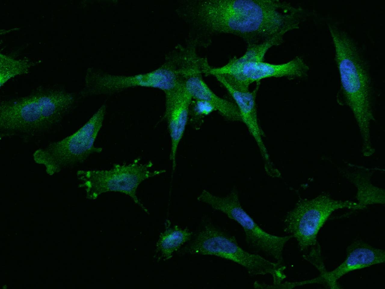 GAK Antibody