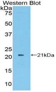 PROS1 / Protein S Antibody (aa481-667, FITC)