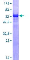 Human TBXT / T / Brachyury Protein (Recombinant GST)