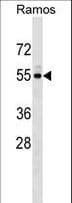 Polyclonal Rabbit anti-Human UNC5CL Antibody (aa192-220, WB)