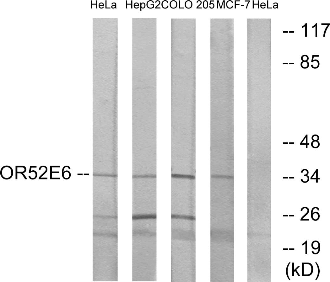 OR52E6 Antibody (aa264-313)