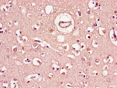 Polyclonal Rabbit anti-Human C1QTNF9B Antibody (IHC, IF)