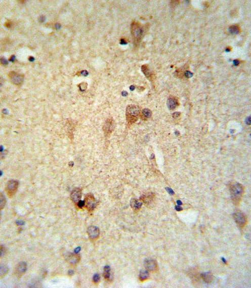 LCAT Antibody (aa285-313)