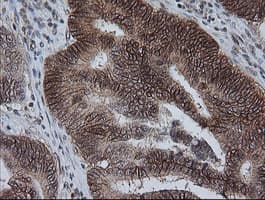 KIF25 Antibody (clone OTI2F4)