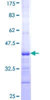 Human NADSYN1 / NAD Synthetase Protein (Recombinant GST, N-terminus)
