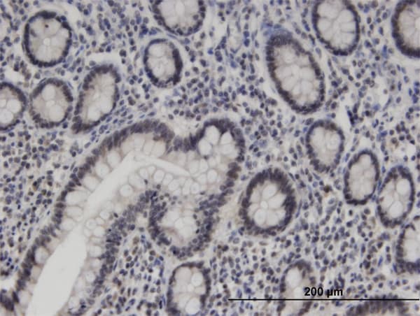 Monoclonal Mouse anti-Human ZNF138 Antibody (clone 4D11, IHC, WB)