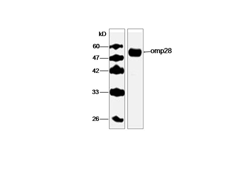 Legionella pneumophila omp28 Antibody (aa47-264, clone 59534-2)