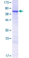 Human KRT32 / Keratin 32 / KRTHA2 Protein (Recombinant GST)