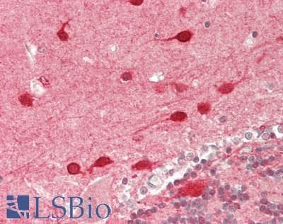 IHC-plus™ Monoclonal Mouse anti-Human MAP1LC3A / LC3A Antibody (clone 5G10, IHC, WB)
