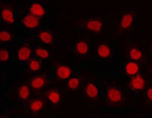 PIAS4 / PIASY Antibody