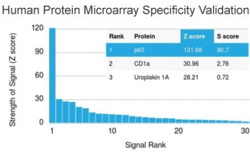 TP63 / p63 Antibody (clone TP63/1786, Azide-free, BSA-free)