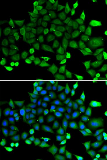 IHC-plus™ Polyclonal Rabbit anti-Human COMMD1 Antibody (IHC, IF, WB)