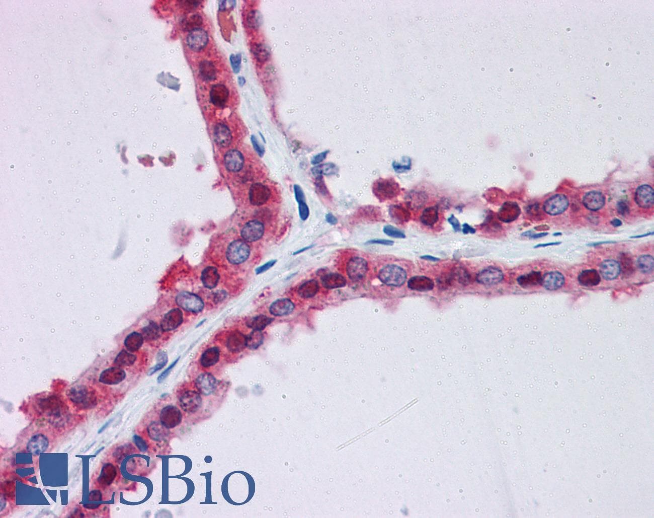 IHC-plus™ Polyclonal Goat anti-Human GPI Antibody (aa120-132, IHC, WB)