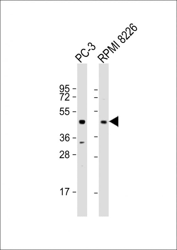ACP6 Antibody (Internal)