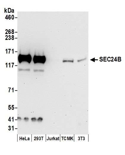 SEC24B Antibody (aa1-50)