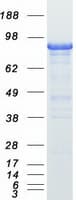 Human BCAR1 / p130Cas Protein (Recombinant Myc-DDK (Flag))