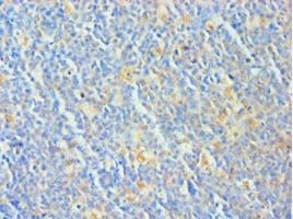 Polyclonal Rabbit anti-Human Treacle / TCOF1 Antibody (aa1189-1488, IHC)