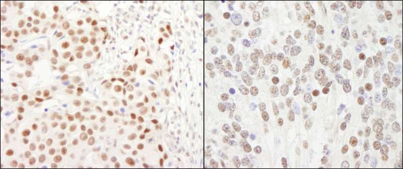 GTF3C5 Antibody (aa469-519)