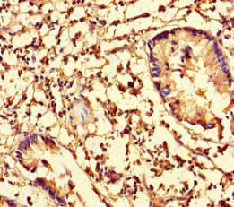 CFL1 / Cofilin Antibody