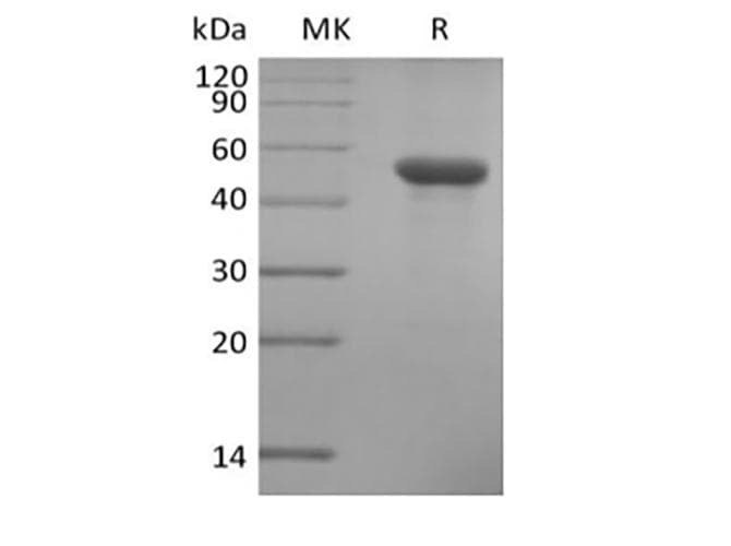 Human ILDR2 Protein (Recombinant 6His, C-terminus)