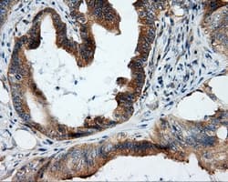Monoclonal Mouse anti-Human RIP1 / RALBP1 Antibody (clone OTI1E2, IHC, IF, WB)