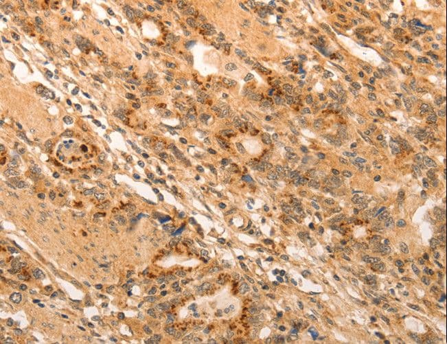 ADRA1B / Adrenoceptor alpha 1B Antibody