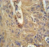 IL5RA / CD125 Antibody (aa49-76)