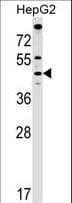 MCAT Antibody (aa316-344)