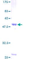 Human LYPLA1 Protein (Recombinant GST)