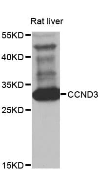 CCND3 / Cyclin D3 Antibody