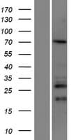 CCDC67 Protein (Over-Expression Lysate Myc-DDK (Flag))