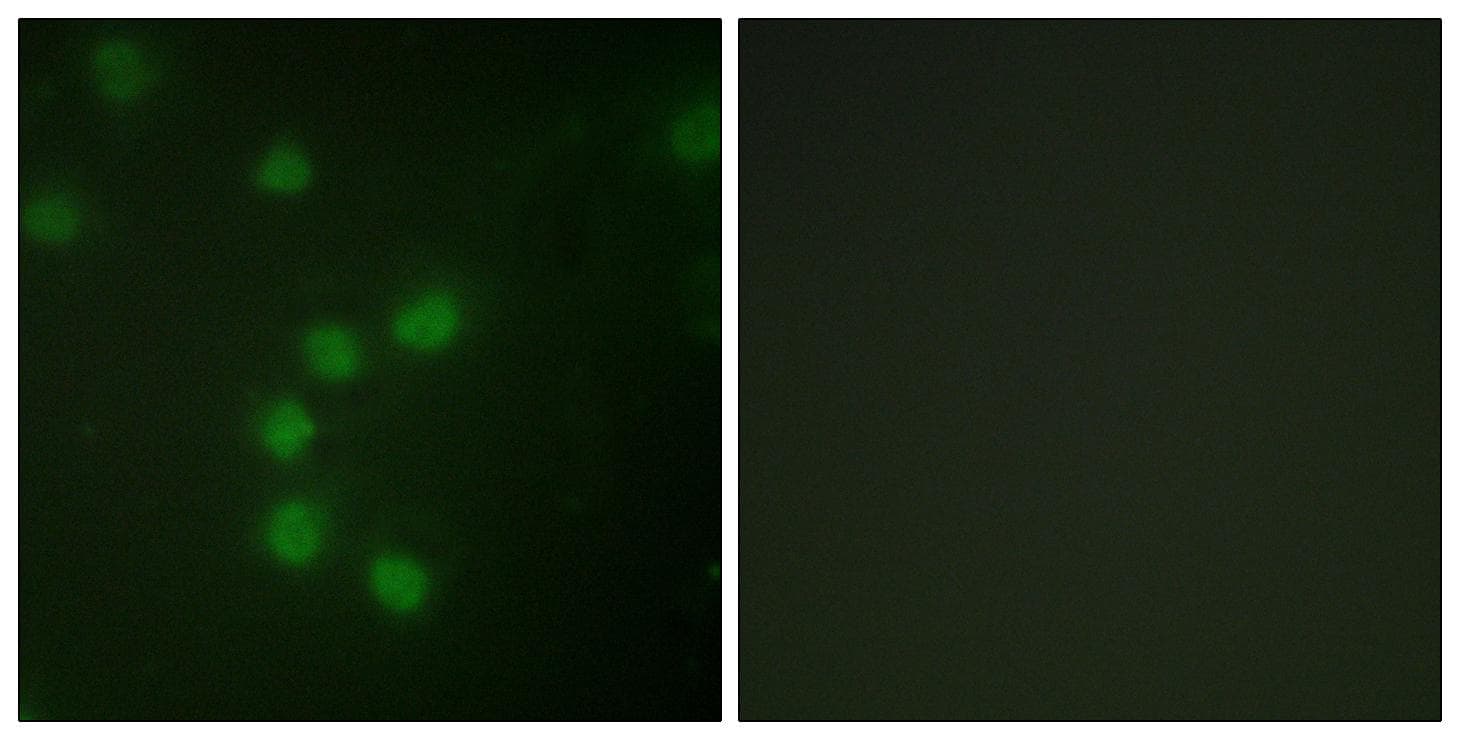 TERT / Telomerase Antibody (Ab-227)
