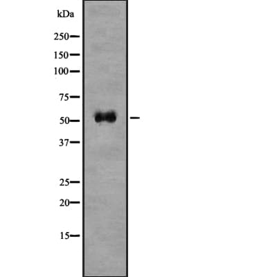 BACE1 / BACE Antibody