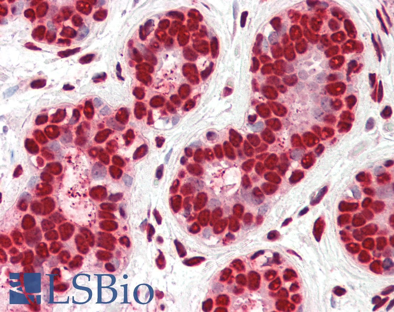 IHC-plus™ Histone H2B Antibody (Acetyl-Lys12)