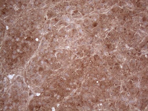 PPA2 Antibody (clone OTI7C1, Carrier-free)