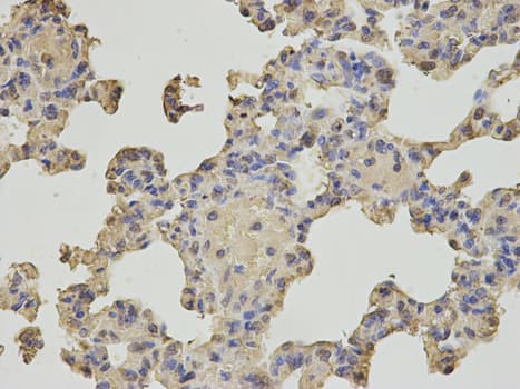 Polyclonal Rabbit anti-Human NUDT1 / MTH1 Antibody (IHC, WB)
