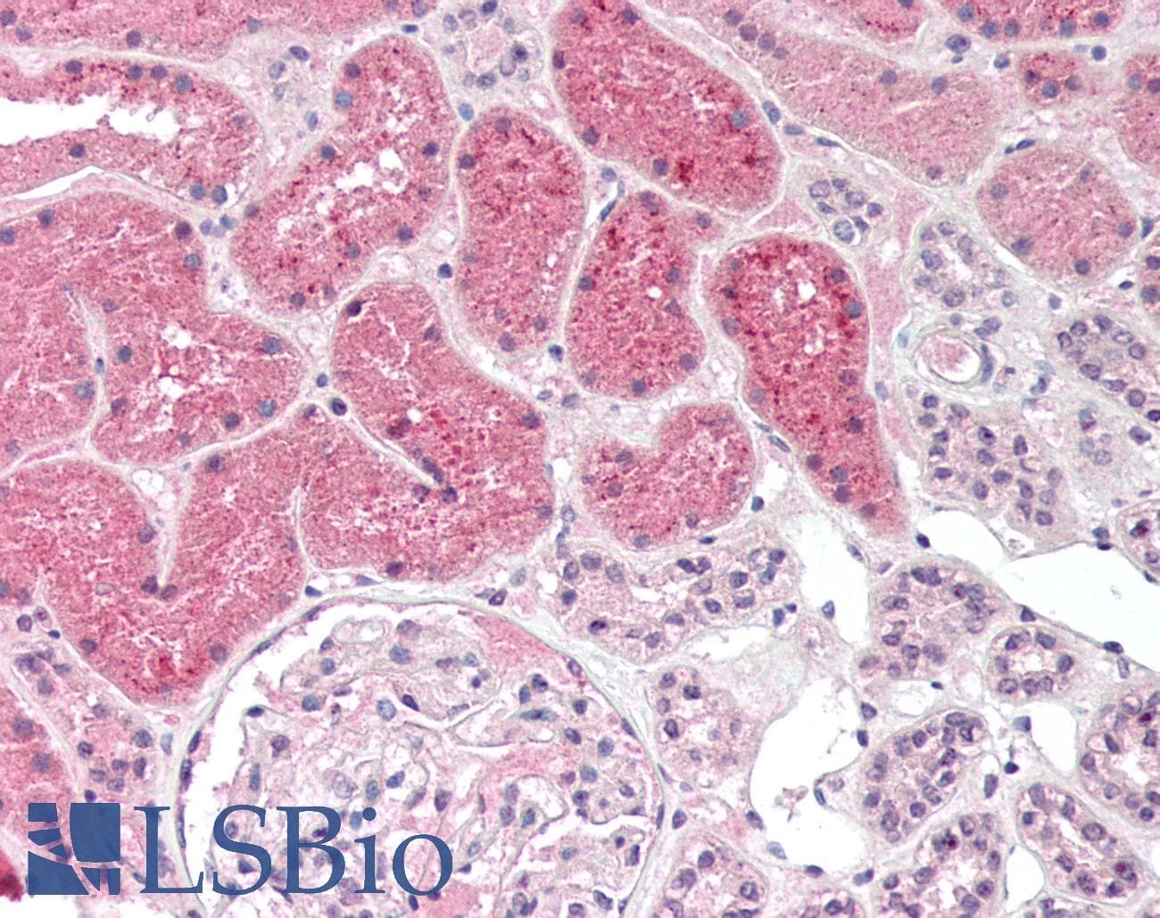 IHC-plus™ ADAP / FYB Antibody (C-Terminus)