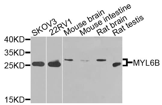 MYL6B Antibody
