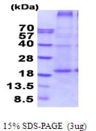 Human CD27L / CD70 Protein (Recombinant His)