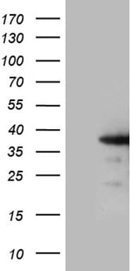 ZCCHC17 / PNO40 / PS1D Antibody (clone OTI9A7)