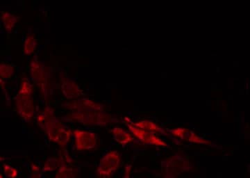 Polyclonal Rabbit anti-Human CABP7 Antibody (IHC, IF, WB)