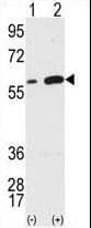 Vimentin Antibody (aa152-181)