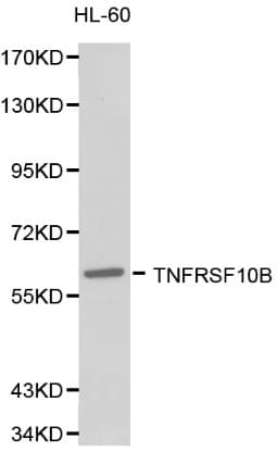 TNFRSF10B / Killer / DR5 Antibody