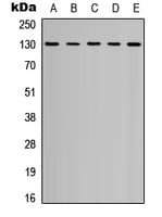Polyclonal Rabbit anti-Human PECAM-1 / CD31 Antibody (C-Terminus, WB)