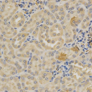 SELL / L-Selectin / CD62L Antibody