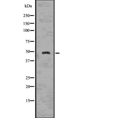 CSNK2A1 Antibody