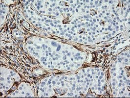 ADH2 / ADH1B Antibody (clone OTI3F2)