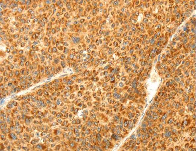 Polyclonal Rabbit anti-Human DIABLO / SMAC Antibody (IHC, WB)